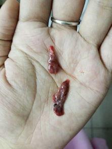 流产吃籽瓜好吗,籽瓜的适宜食用探讨